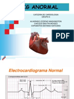 Cardio Ekg Anormal