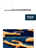 Gonorrea o Blenorragia