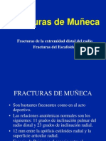 Muneca Fracturas 