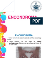 Encondroma