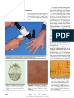 Diagnosis of Scabies With Dermos