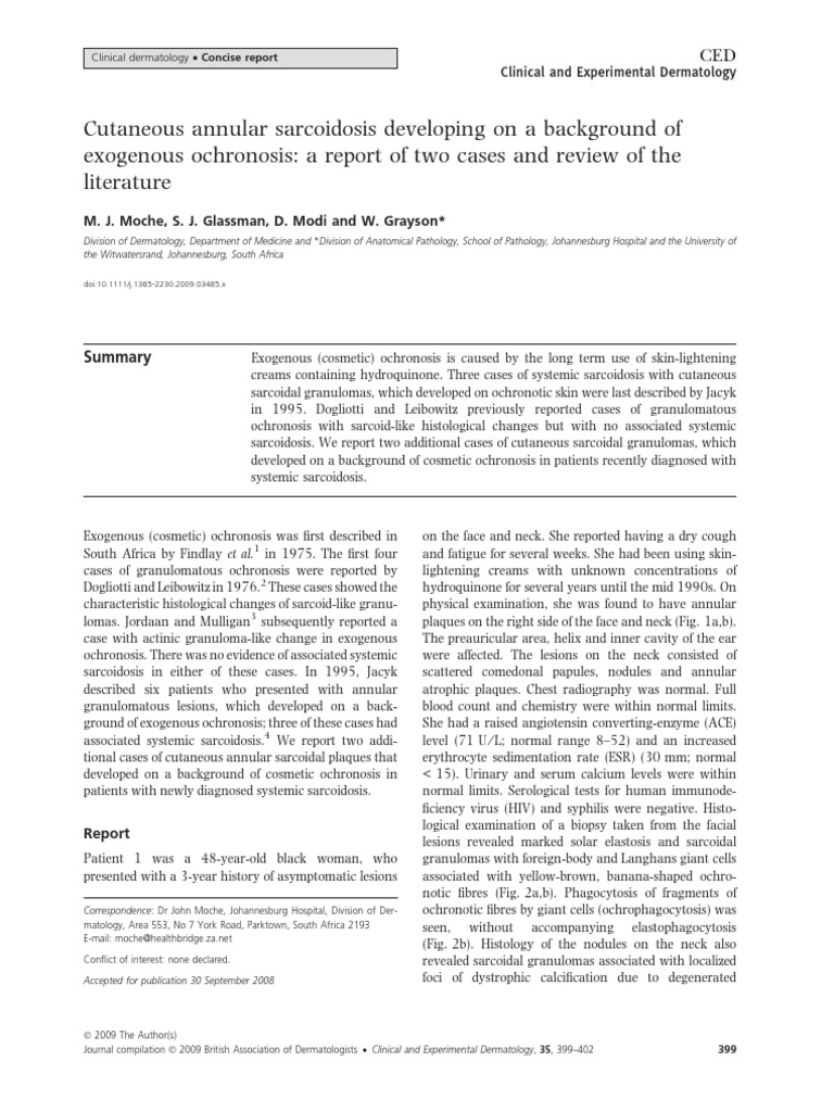 Cutaneous Annular Sarcoidosis Developing On A Background of Exogenous