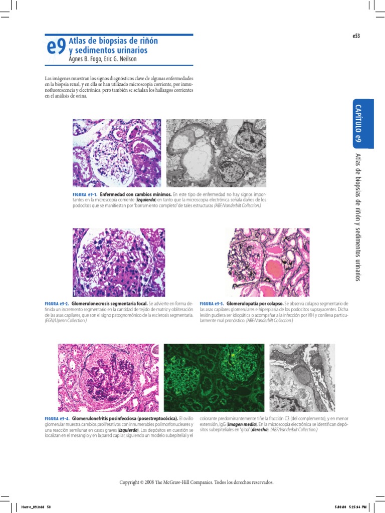 Atlas de Biopsias de Riñon PDF | PDF | Riñón | Nefrología