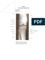 radiologi imaging in reumatoid artritis