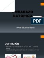 embarazo ectopico