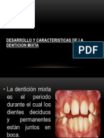 Desarrollo y Caracteristicas de La Denticion Mixta