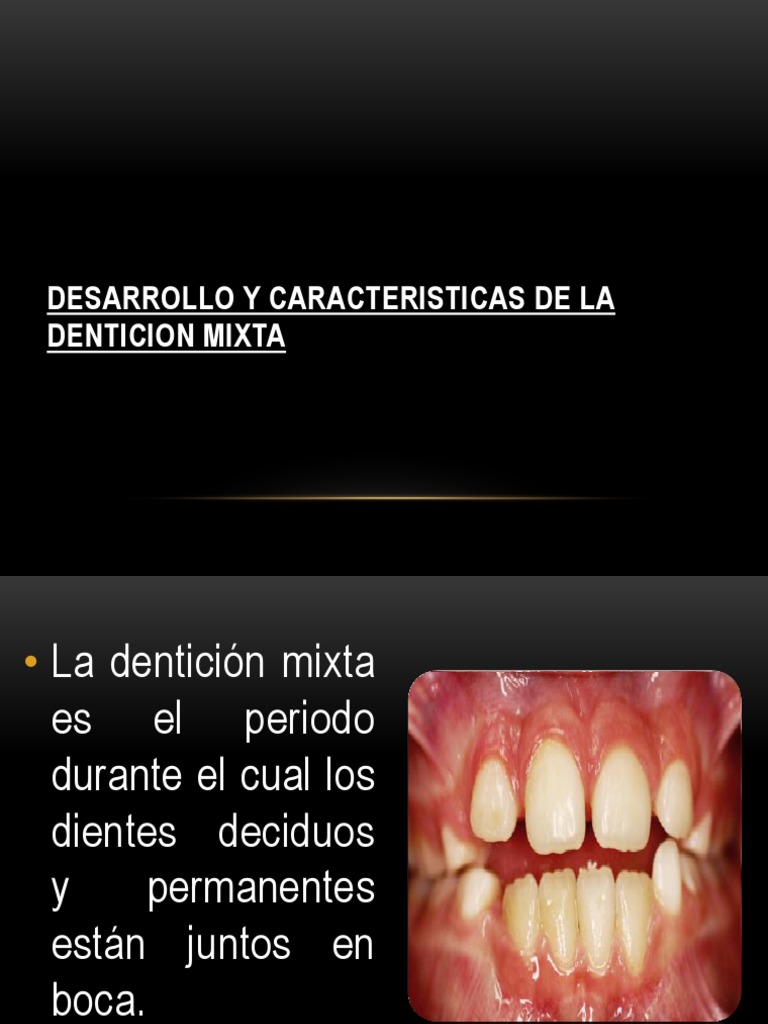 Desarrollo y Caracteristicas de La Denticion Mixta | PDF