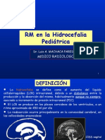 12 RM en Hidrocefalia