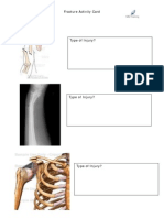 HO24 Fracture Activity Sheets