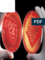 MicroBiologia: Medio de Cultivo Agar Sangre