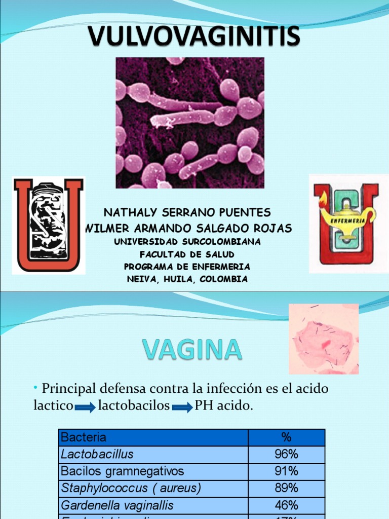 VULVOVAGINITIS Especialidades Medicas Enfermedades y trastornos