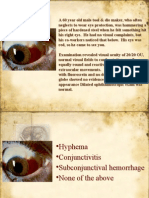 Mcq Ophthalmology