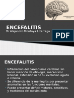 ENCEFALITIS