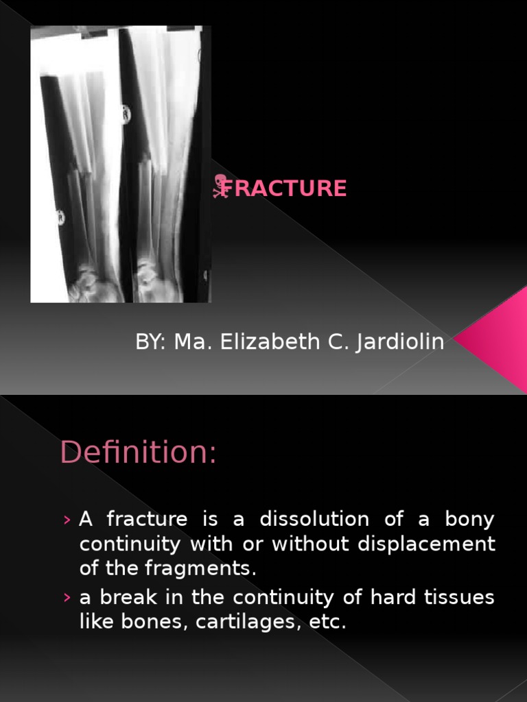 Understanding Bone Fractures: Types & Treatment | PDF | Skeletal System ...