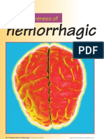 Haemorrhagic Stroke