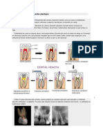 Endo Don Tie