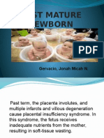Post Mature Newborn: Gervacio, Jonah Micah N
