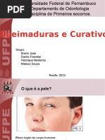 Queimaduras e Curativos