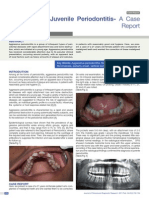 Juvenile Periodontitis-Case Report