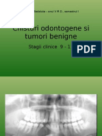 Chisturi Odontogene Si Tumori Benigne - Stagii 9-11