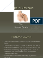 Fraktur Clavicula Panduan Lengkap