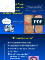 Techniques of Tooth Surface Assessment-Indications For Sealant Placement