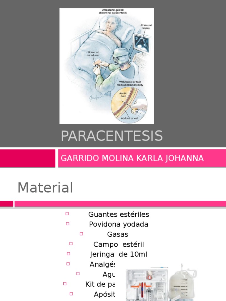 Paracentesis | PDF