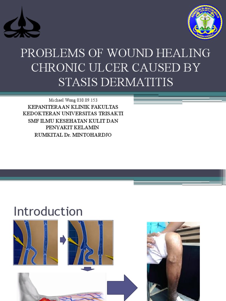 Stasis Dermatitis: Chronic Ulcer Treatment | PDF | Science & Mathematics