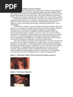 Tuberculose Cutanea, Descrição, Medicina