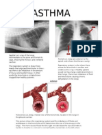 Asthma project