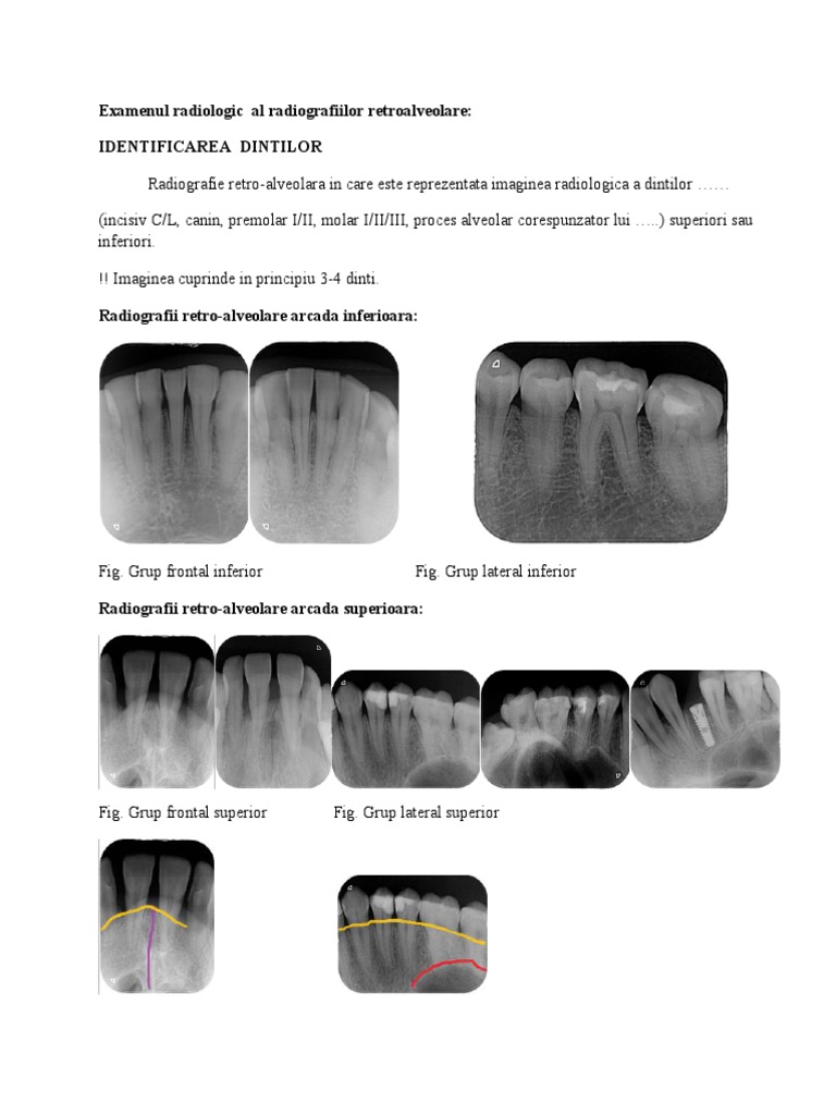 RX Endo | PDF