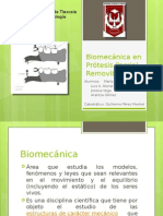 Biomecánica en Prótesis Parcial Removible