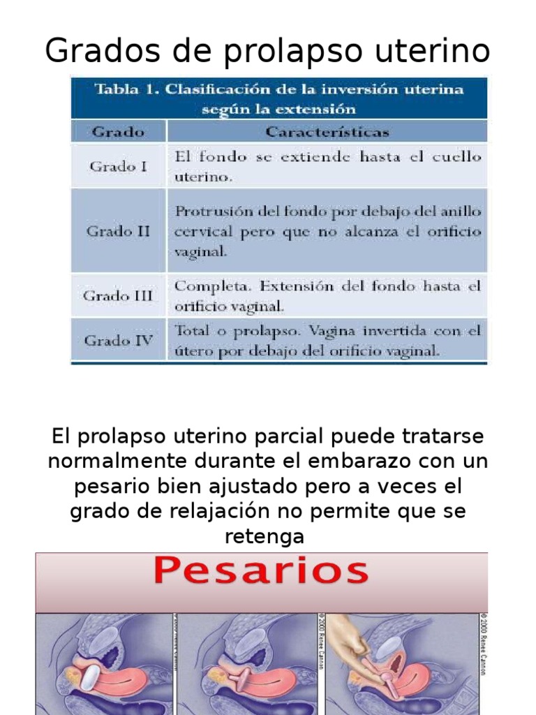 Grados de Prolapso Uterino | PDF