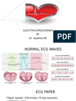 Electrocardiogram BY Dr. Ayesha AR