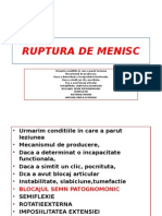 Ruptura de Menisc