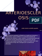 Arterioesclerosis