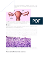 Malformacines Uterinas