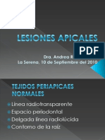 LESIONES APICALES en Radiologia