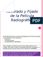 Revelado y Fijado de La Radiografia