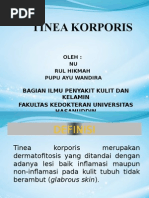 Download Tinea Korporis by Puput Ayu Wandira SN254378612 doc pdf