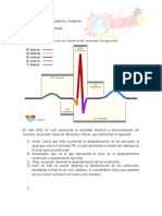 Ekg