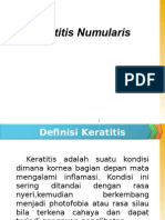 Keratitis Numularis 