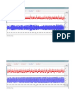 Figura Puls Pletismografic