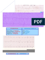 Ejemplos de Ekg