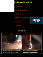 Eyelash Disorders Guide