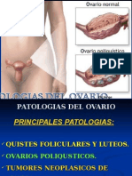 Patologías de Ovarios 