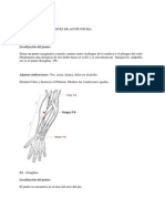 Puntos Mas Importantes de Acupuntura