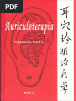 AURICULOTERAPIA