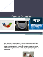 Ferulas Oclusales