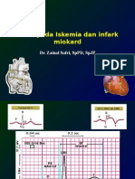 Ekg Acs 2